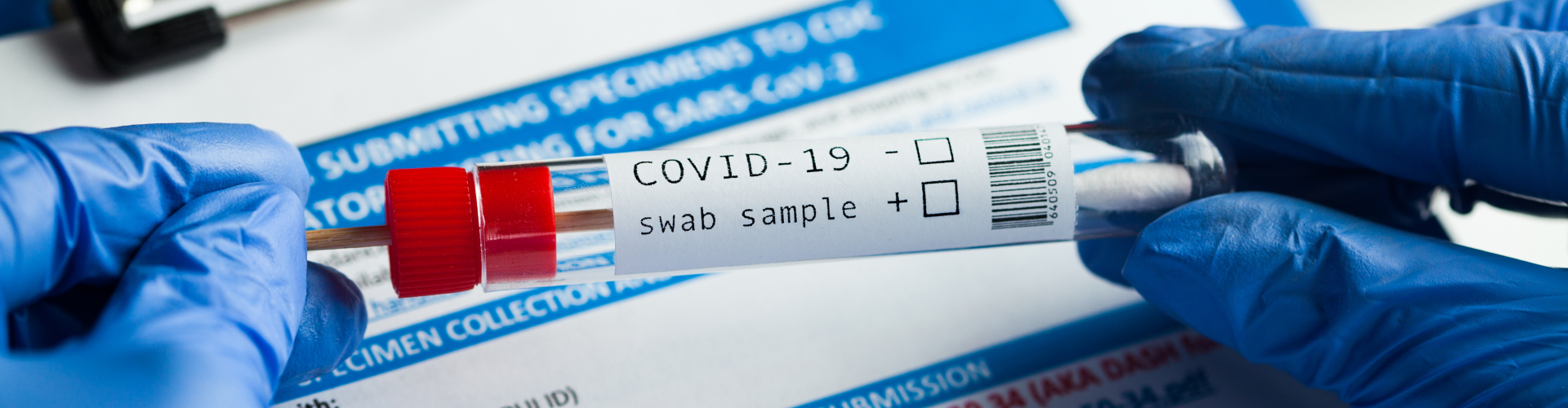 covid 19 swab sample